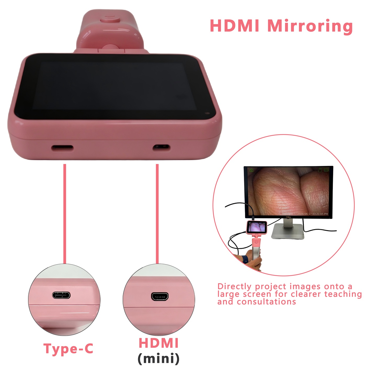 Laryngoscope vidéo à écran tac - Home Cooking Videos avis et prix